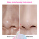 4in1 Glass Tube Acne Wand
