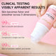 Body Cream Chicken Skin Removal Treatment Keratosis Pilaris Lotion Rough Bumpy Pore Spots Care Moisturizer Whitening Creams 60g