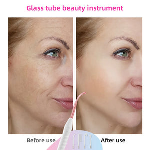 4in1 Glass Tube Acne Wand