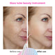 4in1 Glass Tube Acne Wand